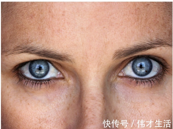 吴晴|气血不足导致黄褐斑和暗沉，医生表示吃两物做一事，能够淡斑