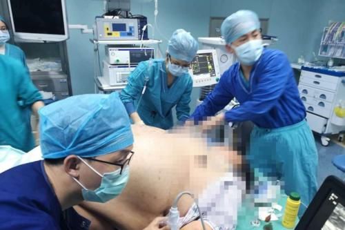 控制|318斤孕妈生娃被调侃，“像大海捞针”，孕期控制体重牢记4点