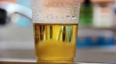 肝脏|肝不好的人,早上起床后,若有4个现象,恭喜你,肝脏正在好转