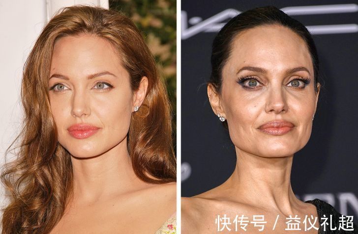 真实年龄|9个“直接戳破真实年龄”的衰老迹象,化妆也遮不住