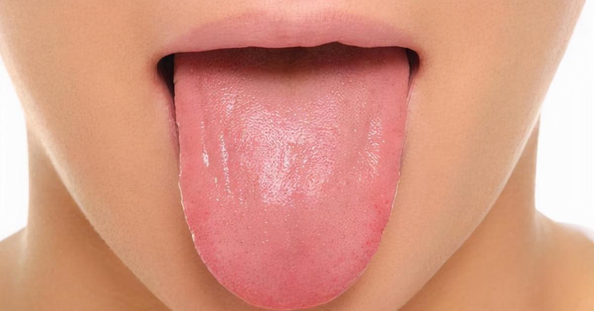 湿气|脾胃不好，舌苔白厚有齿痕、舌头有裂痕，该怎么调理？