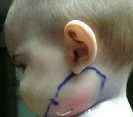 羽毛|妈妈发现宝宝脸上长出了一根羽毛,医生检查的结果吓坏妈妈