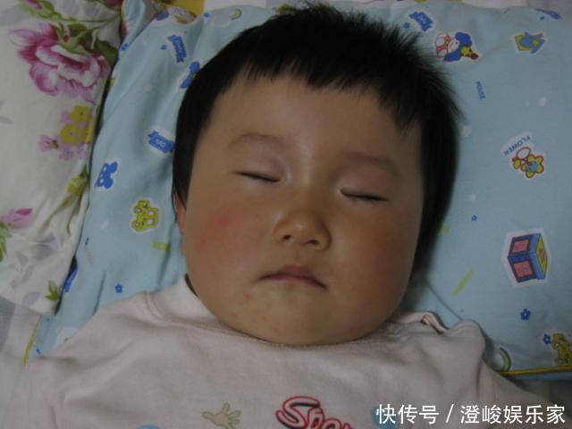 护理|宝宝出现9个特点,可能是患急疹了,教你5个方法,在家就能护理