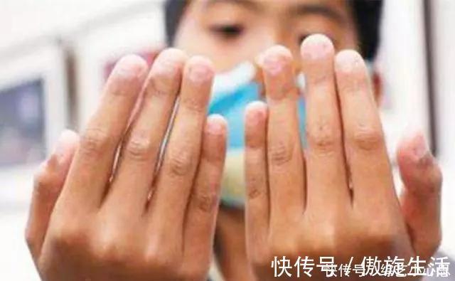 性格|小时候爱''咬指甲''的孩子,长大后多半是这2种性格,太心疼孩子了
