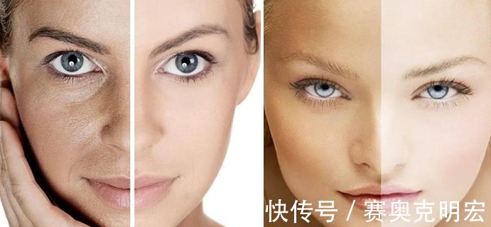 维c|怎么快速让皮肤一天变白?脸部美白的最有效方法小妙招(15种)