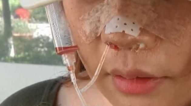 女子|妙龄女子花6万整容,如今脸上天天挂着注射器,医院:赔你13000元