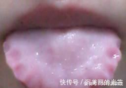 疾病|早晚吃一物,排出体内多年湿气,健康又漂亮,神奇!