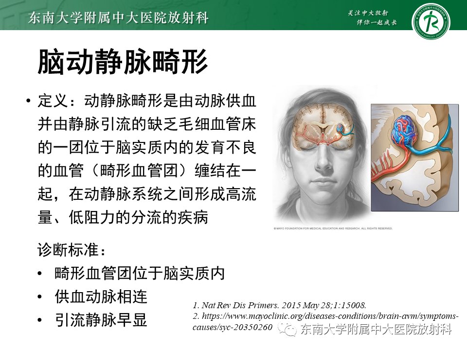 影像学|脑动静脉畸形影像学特征