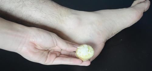  脚后跟干裂脱皮不用愁，教你一个土方法，轻松解决，省钱又实用