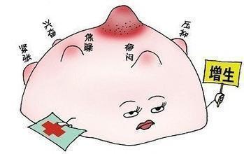 放屁很多是大肠癌吗,很可能与三个原因有关,尽早去医院体检一下