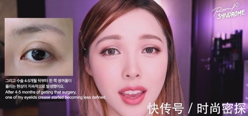 整型 美妆教主Pony大方坦承整形两次!术后跟粉丝分享“术前VS术后”!