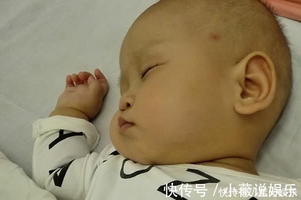 医生|为啥有的宝宝出生后，身上会有胎记医生原因可能令你意外