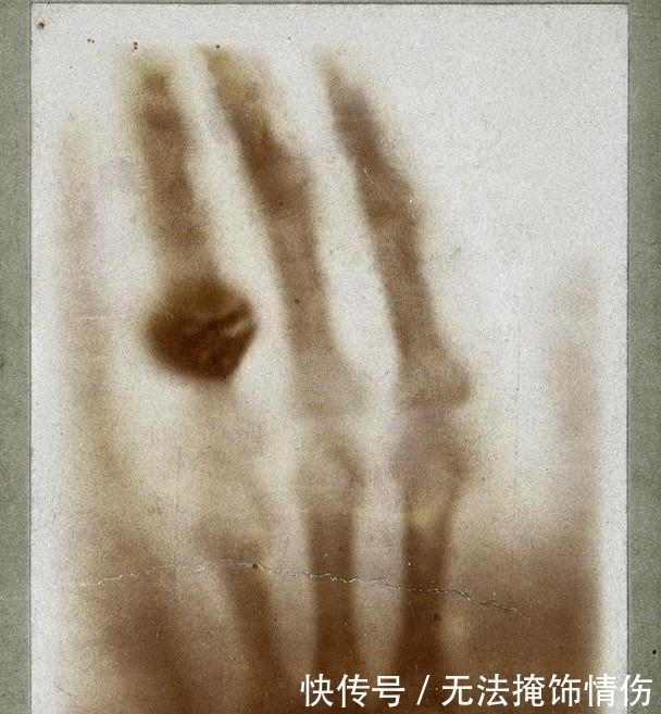 物理 简要回顾X射线的科学史,分析其物理意义和影响