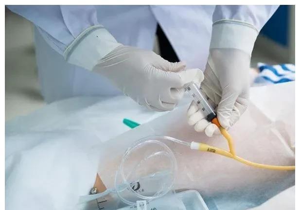 日记|分娩日记14没有羊水+绕颈两圈,胎盘功能三级,立即插队剖腹产