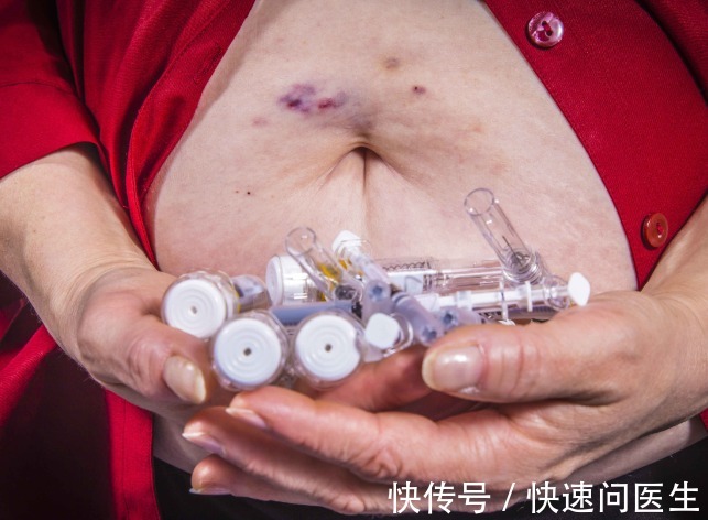 胰岛素受体|为什么会患上糖尿病?医生:其实主要涉及到3个方面!