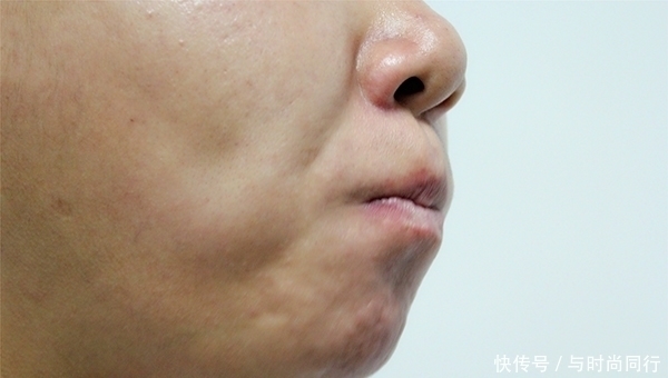 一个月|医生：脑梗其实很少“突发”，发作前一个月左右就有信号，别忽视