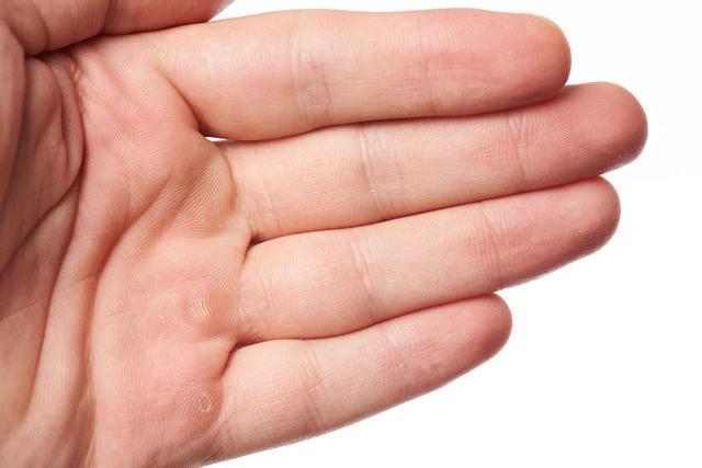 手掌上的这些信号预示血栓,如果不注意当心引发心梗