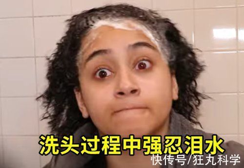 皮肤过敏|居然有人对水过敏！那该怎么洗澡、喝水、上厕所？