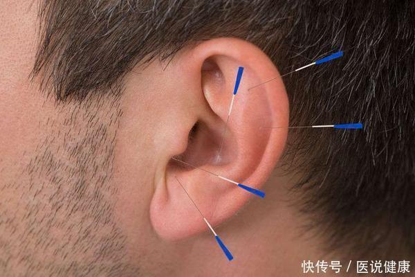 高血脂|血脂高上半身先知?医生:上半身若出现这5种异常,要重视!