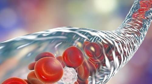 锻炼|常做俯卧撑好处多,那么一天练习多少个比较好呢