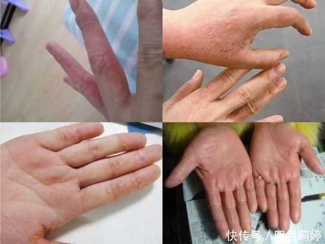 日本变态手霜，效果堪比“换皮”轻轻一抹，双手一夜重回婴儿肌