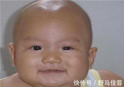 宝妈|囟门被称为宝宝的“命门”,若出现这几种形态,别耽搁赶紧去医院