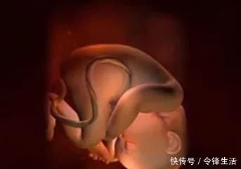 肚子|35周胎儿在肚子里总是鼓包包,肚子发硬,吸收有点难受正常吗?