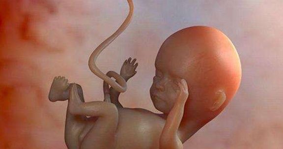 胎心|胎儿脐带绕颈影响顺产，要想避免，孕妈一定得注意这4个方面！