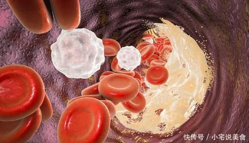 血小板|打通血管血栓的绝密配方,一个月内阻塞血管全部疏通?