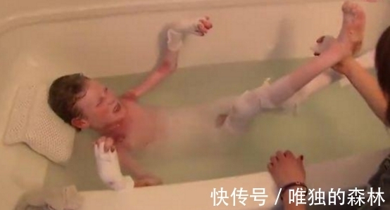 皮肤|男孩皮肤一碰就流血,每天裹满纱布,泡在浴缸里减轻痛苦