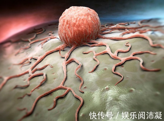 贫血|得了肿瘤到底要不要放化疗,大夫说3类人一定不可放化疗