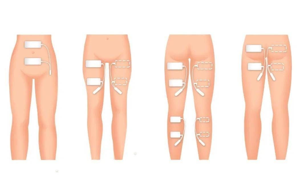 生完孩子应该什么时候开始塑形？