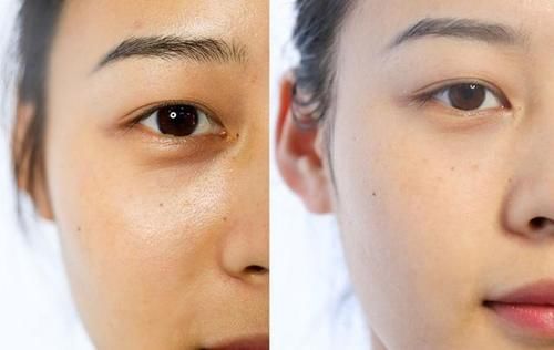 眼袋和黑眼圈是我们的颜值“天敌”！该如何应对？这3招或可参考