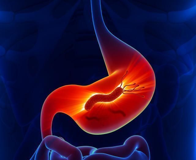 幽门螺旋杆菌有“死对头”吗平时多吃它,杀菌养胃,胃慢慢变好