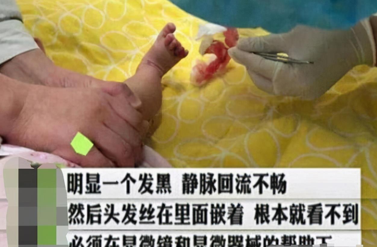 宝宝|1周岁宝宝脚趾进“虫”,宝妈急忙带娃就医,医生:来得及时