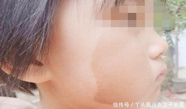 这三种行为会导致娃出生后有“胎记,”不想宝宝有,孕妈最好别做!