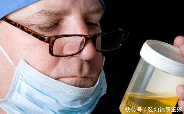 尿液有泡沫是怎么回事肾脏有问题原因可能有这