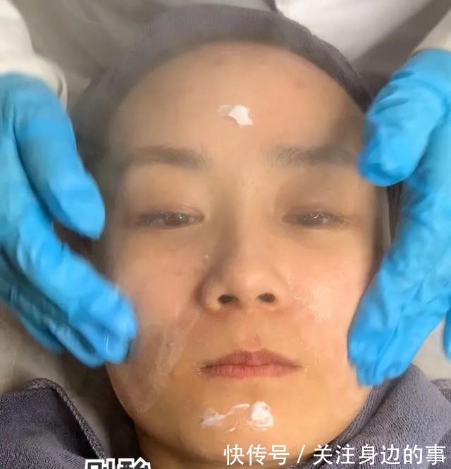 大油皮 大油皮必看!花费10000元总结出来的医美项目推荐!