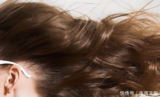 头上有这“3个表现”，很可能是有螨虫“做窝”，尽早处理一下