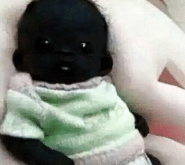 我们的生活|那个一出生黑成“球”的黑宝宝,过去5年了,他变成啥样子了