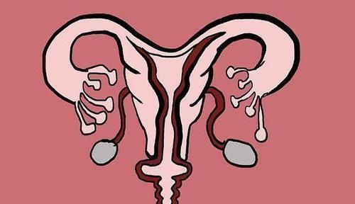 冰奶茶|女性纵容的几个随意行为,让子宫很受伤,请你学会爱自己