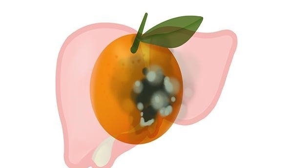 肝一硬,屁就多?乙肝患者屁多,是肝硬化的信号吗?听听专家咋说