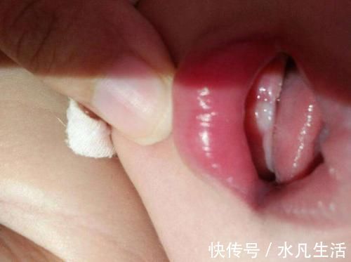 宝宝|宝宝出生就有牙齿？妈妈炫耀孩子发育早，医生却直言道：高兴太早