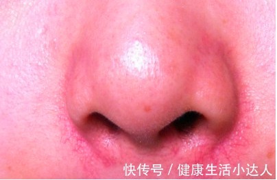 肝癌|身体出现5种变化，肝已受损，不想彻底坏掉，2大伤肝毒物要少吃