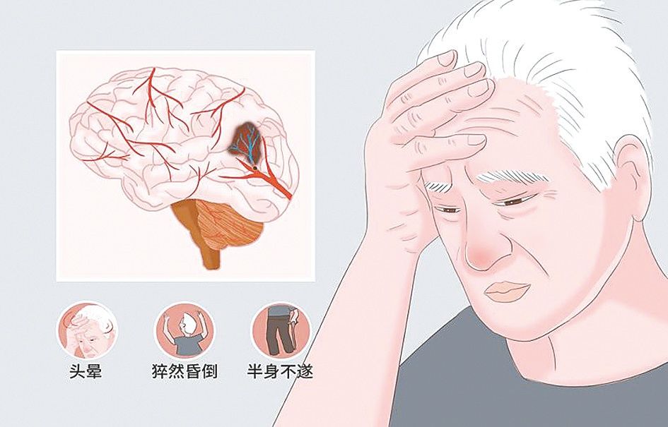 出血性疾病|关注血管 预防硬化$$1