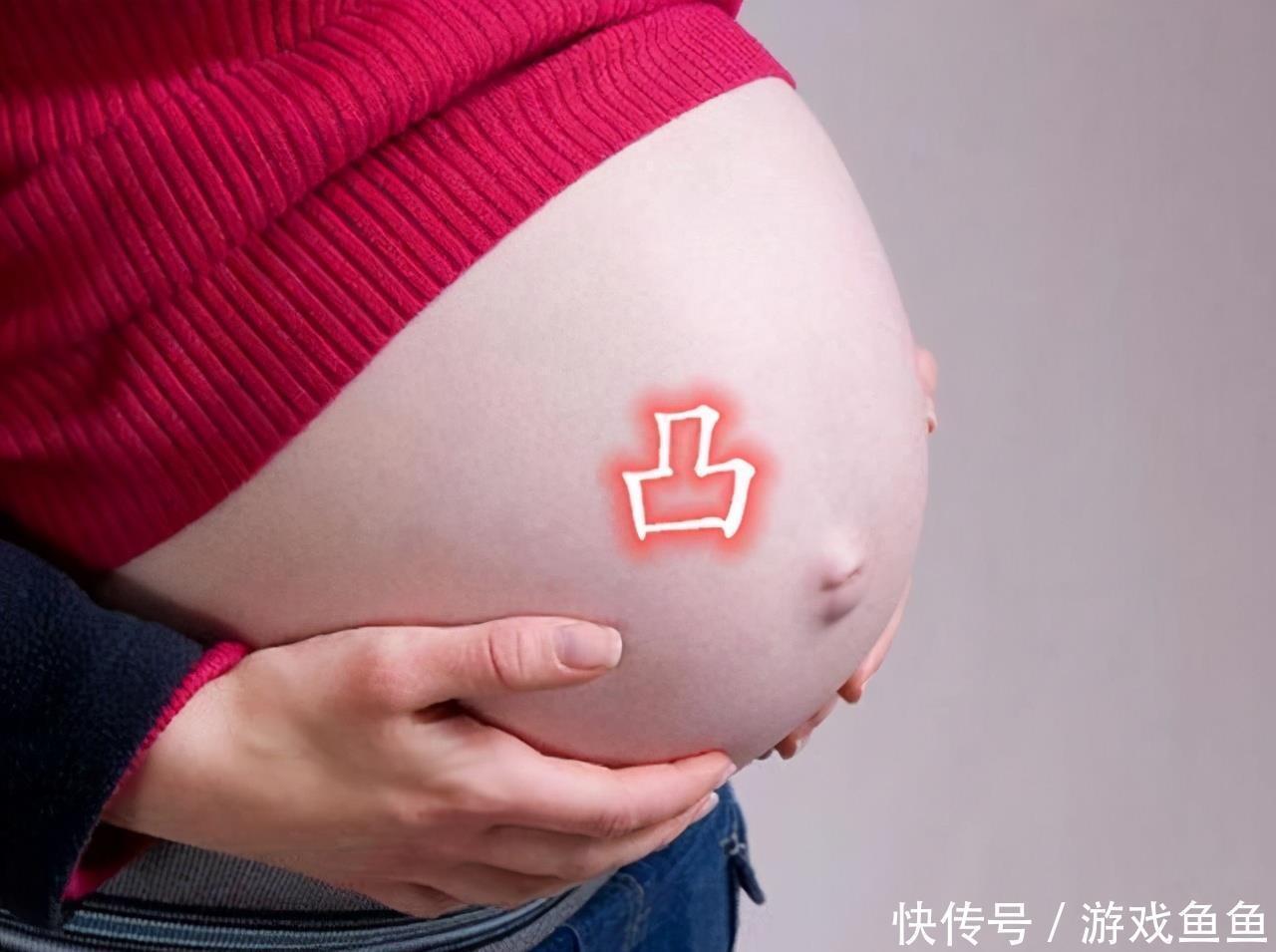 身体乳|孕妇肚脐“凸出来”,说明怀的是男孩?造成肚脐凸和凹的原因在这