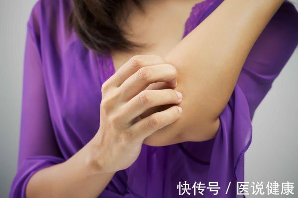 患者|患上淋巴瘤后,身体或有3个症状表现,发现后,需及时治疗