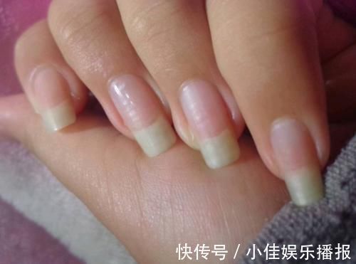 长头发|人闲下来是不是容易长指甲,心宽的人是不是容易长头发?