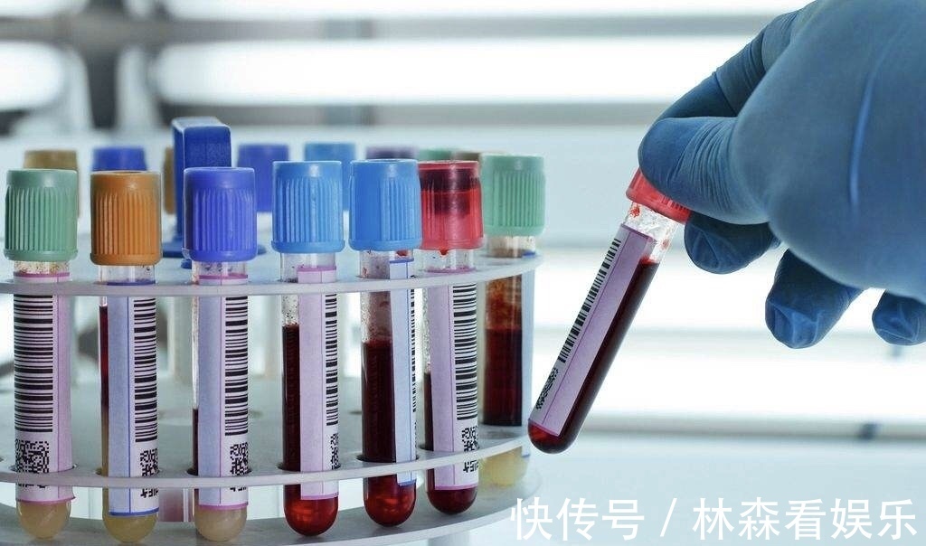 寿命|血型可能决定着你的寿命,最长寿的血型是这种,你是什么血型