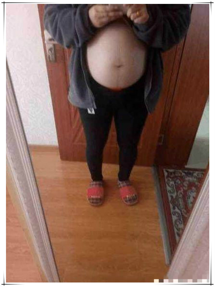 孕妇|孕妇“悬垂肚”走红,网友猜测是“双胞胎”:没见过这样的孕肚